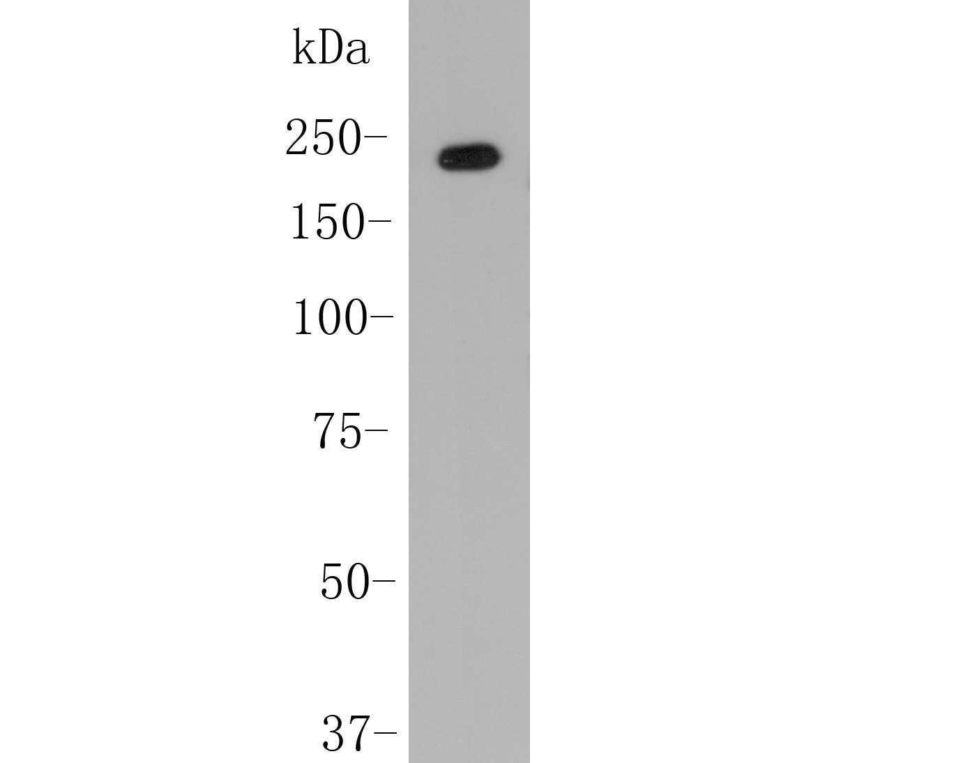 Western blot analysis of Kidins220 on K562 cell lysate. Proteins were transferred to a PVDF membrane and blocked with 5% BSA in PBS for 1 hour at room temperature. The primary antibody (M0910-4, 1/500) was used in 5% BSA at room temperature for 2 hours. Goat Anti-Mouse IgG - HRP Secondary Antibody (HA1006) at 1:5,000 dilution was used for 1 hour at room temperature.
