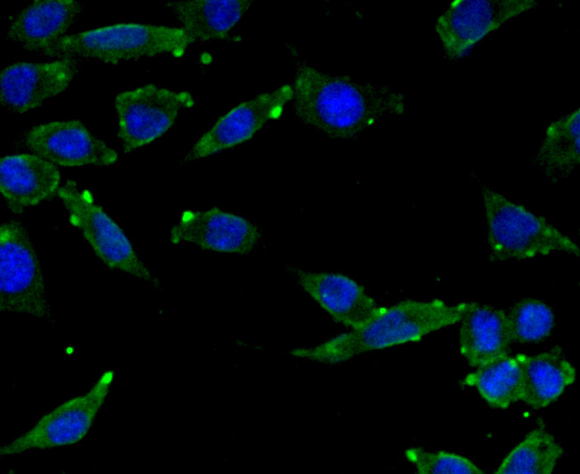 ICC staining SCAI in SH-SY-5Y cells (green). The nuclear counter stain is DAPI (blue). Cells were fixed in paraformaldehyde, permeabilised with 0.25% Triton X100/PBS.