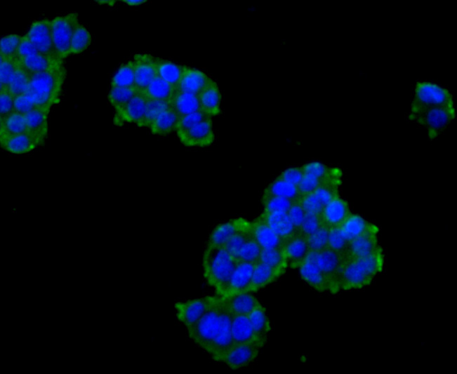 ICC staining SCAI in PC-12 cells (green). The nuclear counter stain is DAPI (blue). Cells were fixed in paraformaldehyde, permeabilised with 0.25% Triton X100/PBS.