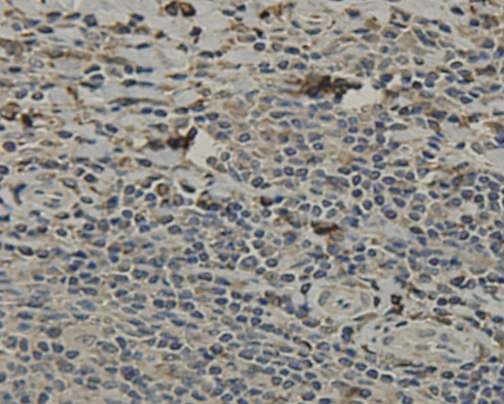Immunohistochemical analysis of paraffin-embedded human tonsil tissue using anti-SCAI antibody. Counter stained with hematoxylin.