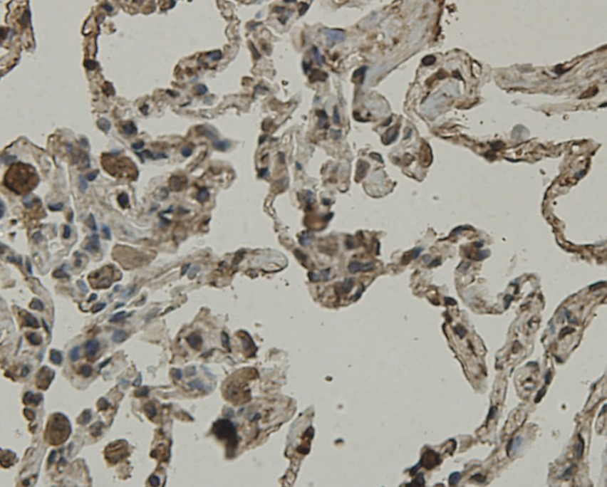 Immunohistochemical analysis of paraffin-embedded human lung tissue using anti-SCAI antibody. Counter stained with hematoxylin.