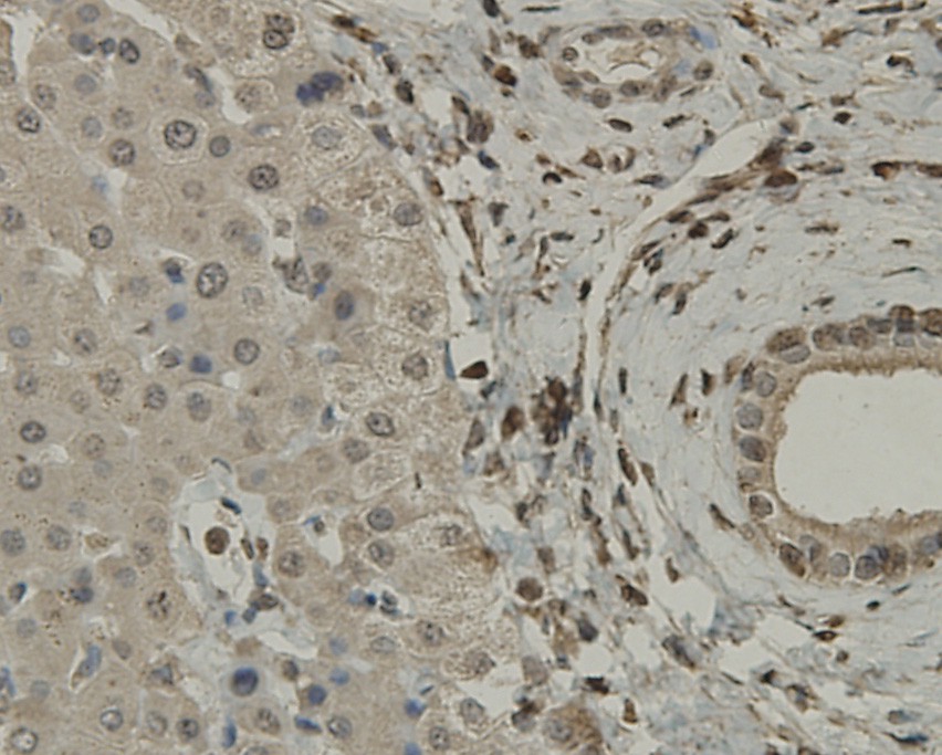 Immunohistochemical analysis of paraffin-embedded human liver tissue using anti-SCAI antibody. Counter stained with hematoxylin.