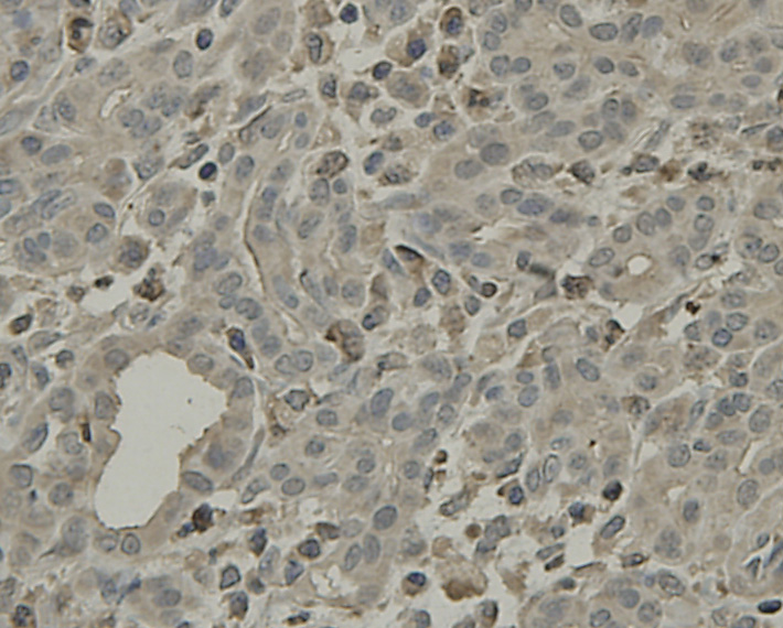Immunohistochemical analysis of paraffin-embedded human pancreas tissue using anti-SCAI antibody. Counter stained with hematoxylin.
