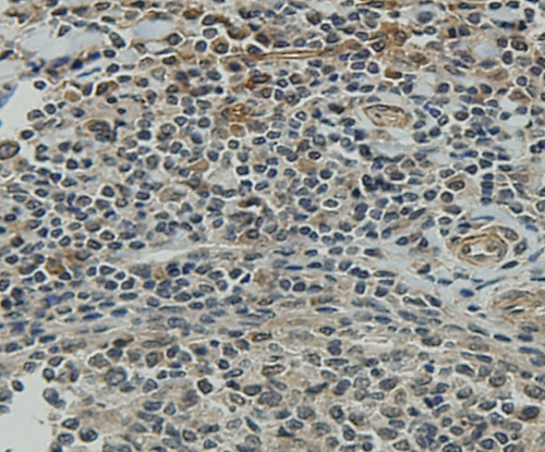 Immunohistochemical analysis of paraffin-embedded human tonsil tissue using anti-CCDC51 antibody. Counter stained with hematoxylin