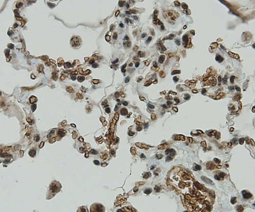 Immunohistochemical analysis of paraffin-embedded human lung tissue using anti-CCDC51 antibody. Counter stained with hematoxylin.