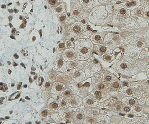 Immunohistochemical analysis of paraffin-embedded human liver tissue using anti-CCDC51 antibody. Counter stained with hematoxylin.