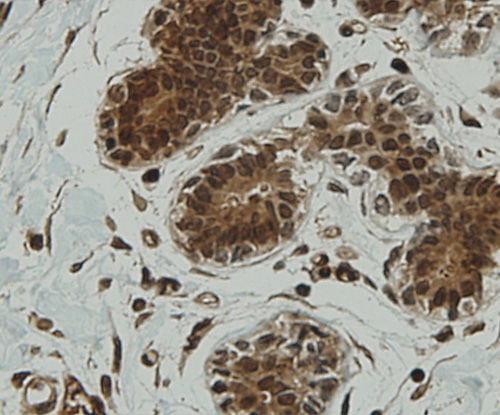 Immunohistochemical analysis of paraffin-embedded human breast tissue using anti-CCDC51 antibody. Counter stained with hematoxylin.