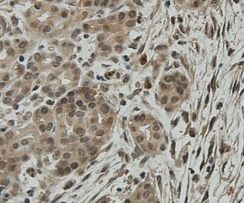 Immunohistochemical analysis of paraffin-embedded human pancreas tissue using anti-CCDC51 antibody. Counter stained with hematoxylin.