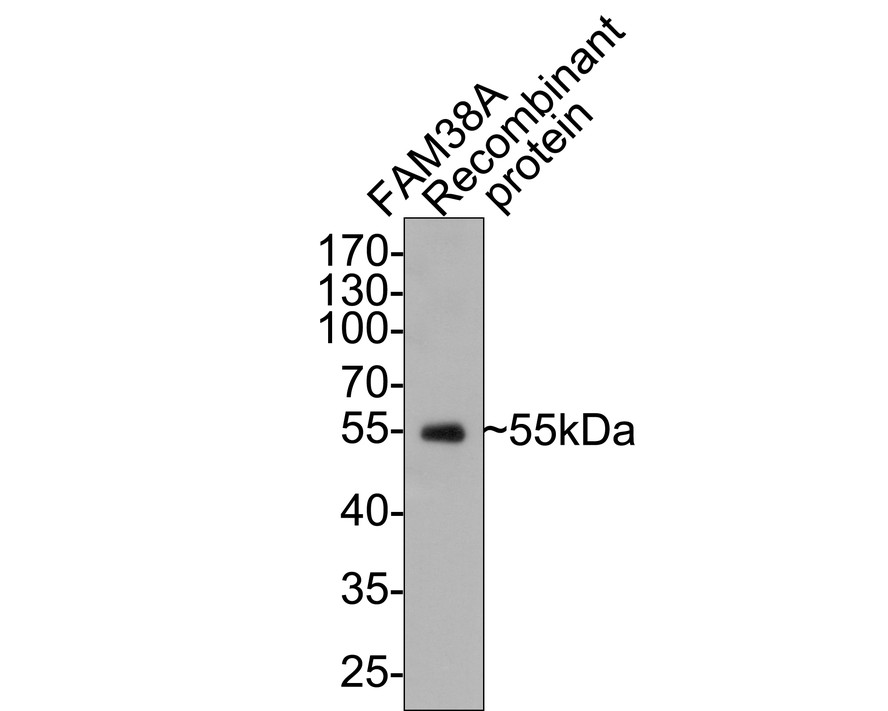 Western blot analysis of FAM38A/PIEZO1 on recombinant protein with Mouse anti-FAM38A/PIEZO1 antibody (M1005-2) at 1/500 dilution.<br />
<br />
Lysates/proteins at 50 ng/Lane.<br />
<br />
Exposure time: 1 minute;<br />
<br />
10% SDS-PAGE gel.<br />
<br />
Proteins were transferred to a PVDF membrane and blocked with 5% NFDM/TBST for 1 hour at room temperature. The primary antibody (M1005-2) at 1/500 dilution was used in 5% NFDM/TBST at room temperature for 2 hours. Goat Anti-Mouse IgG - HRP Secondary Antibody (HA1006) at 1:100,000 dilution was used for 1 hour at room temperature.