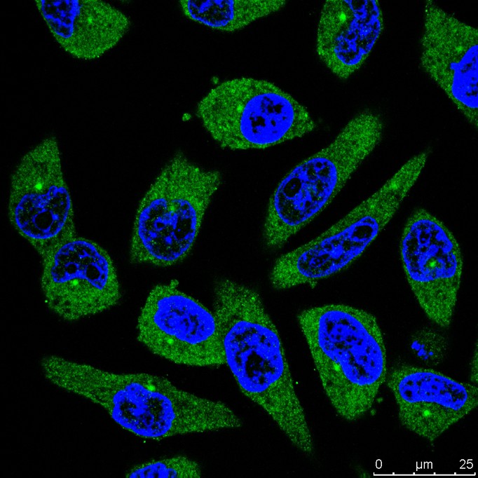Immunocytochemistry analysis of Hela cells labeling FAM38A/PIEZO1 with Mouse anti-FAM38A/PIEZO1 antibody (M1005-2) at 1/100 dilution.<br />
<br />
Cells were fixed in 4% paraformaldehyde for 30 minutes, permeabilized with 0.1% Triton X-100 in PBS for 15 minutes, and then blocked with 2% BSA for 30 minutes at room temperature. Cells were then incubated with Mouse anti-FAM38A/PIEZO1 antibody (M1005-2) at 1/100 dilution in 2% BSA overnight at 4 ℃. Goat Anti-Mouse IgG H&L (iFluor™ 488, HA1125) was used as the secondary antibody at 1/1,000 dilution. PBS instead of the primary antibody was used as the secondary antibody only control. Nuclear DNA was labelled in blue with DAPI.