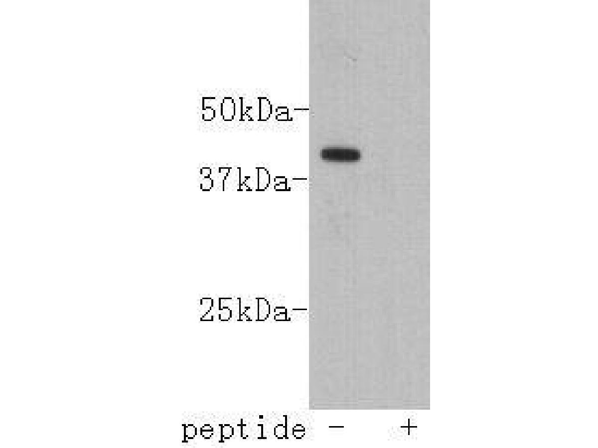 Western blot analysis on K562-AO2 cell lysates using anti-lass2 monoclonal antibody.
