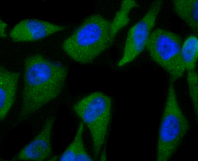 ICC staining C12orf51 (green) in PC-3M cells. The nuclear counter stain is DAPI (blue). Cells were fixed in paraformaldehyde, permeabilised with 0.25% Triton X100/PBS.