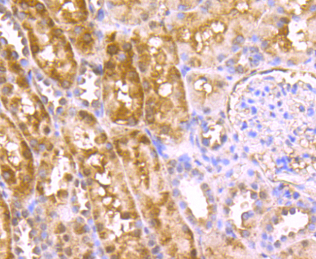 Immunohistochemical analysis of paraffin-embedded human kidney tissue using anti-C12orf51 antibody. Counter stained with hematoxylin.