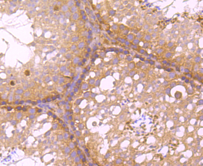 Immunohistochemical analysis of paraffin-embedded mouse testis tissue using anti-C12orf51 antibody. Counter stained with hematoxylin.
