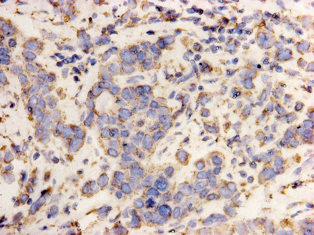 Immunocytochemistry analysis of HepG2 cells labeling HSP60 with Mouse anti-HSP60 antibody (M1007-9) at 1/100 dilution.<br />
<br />
Cells were fixed in 4% paraformaldehyde for 10 minutes at 37 ℃, permeabilized with 0.05% Triton X-100 in PBS for 20 minutes, and then blocked with 2% negative goat serum for 30 minutes at room temperature. Cells were then incubated with Rabbit anti-HSP60 antibody (M1007-9) at 1/100 dilution in 2% negative goat serum overnight at 4 ℃. Goat Anti-Mouse IgG H&L (iFluor™ 488, HA1125) was used as the secondary antibody at 1/1,000 dilution. PBS instead of the primary antibody was used as the secondary antibody only control. Nuclear DNA was labelled in blue with DAPI.