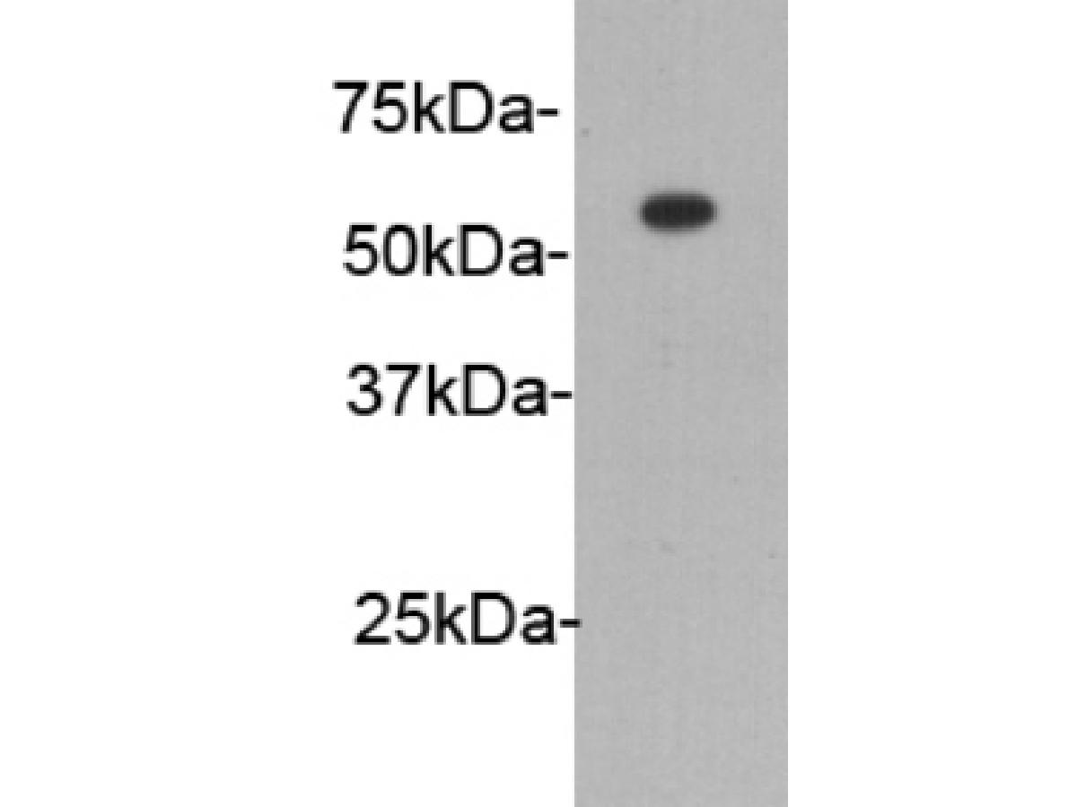 Western blot analysis on recombinant protein with HA tag using anti-HA tag Mouse mAb (Cat. # M1008-1).