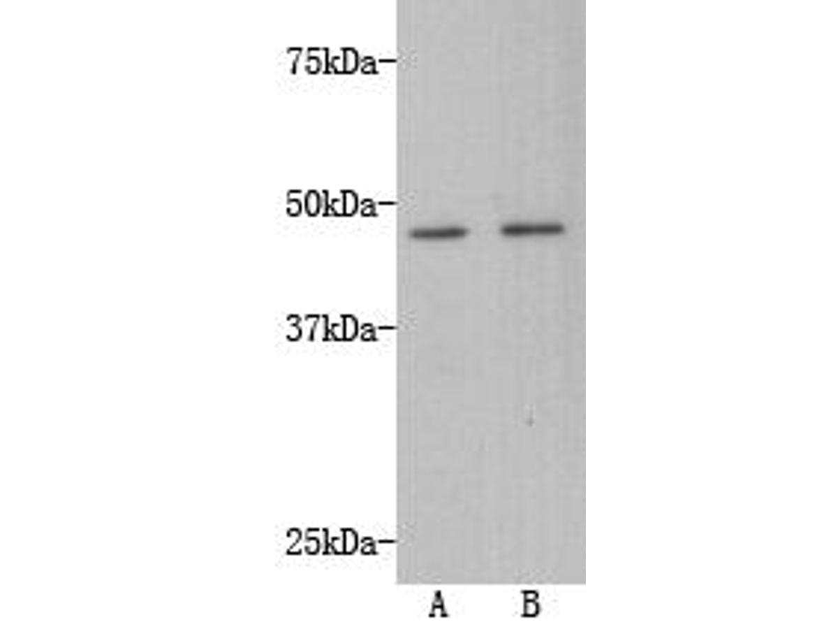 Western blot analysis of Transmembrane protein 200A on A549 (1) and HepG2 (2) using anti-Transmembrane protein 200A antibody at 1/500 dilution.