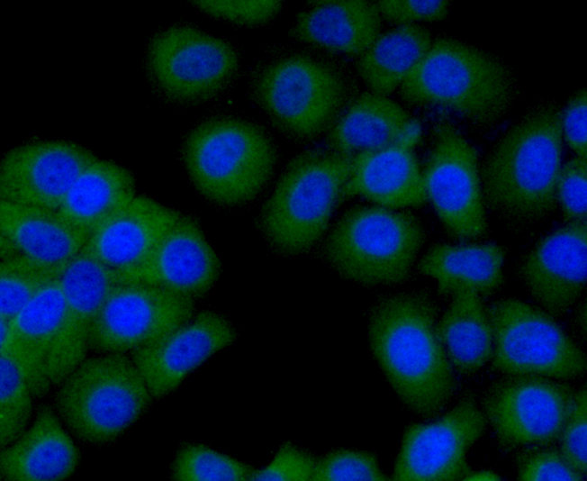 ICC staining Transmembrane protein 200A (green) in HepG2 cells. The nuclear counter stain is DAPI (blue). Cells were fixed in paraformaldehyde, permeabilised with 0.25% Triton X100/PBS.