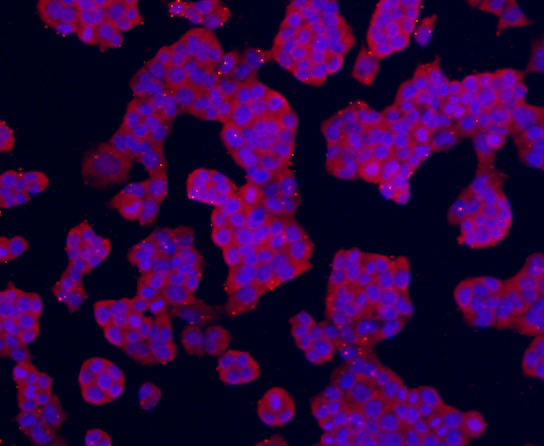 ICC staining Transmembrane protein 200A (red) in NCCIT cells. The nuclear counter stain is DAPI (blue). Cells were fixed in paraformaldehyde, permeabilised with 0.25% Triton X100/PBS.