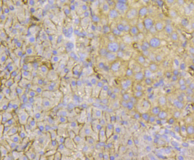 Immunohistochemical analysis of paraffin-embedded human pancreas tissue using anti-Transmembrane protein 200A antibody. Counter stained with hematoxylin.