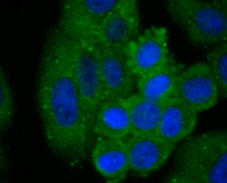 ICC staining C14orf93 in HepG2 cells (green). The nuclear counter stain is DAPI (blue). Cells were fixed in paraformaldehyde, permeabilised with 0.25% Triton X100/PBS.