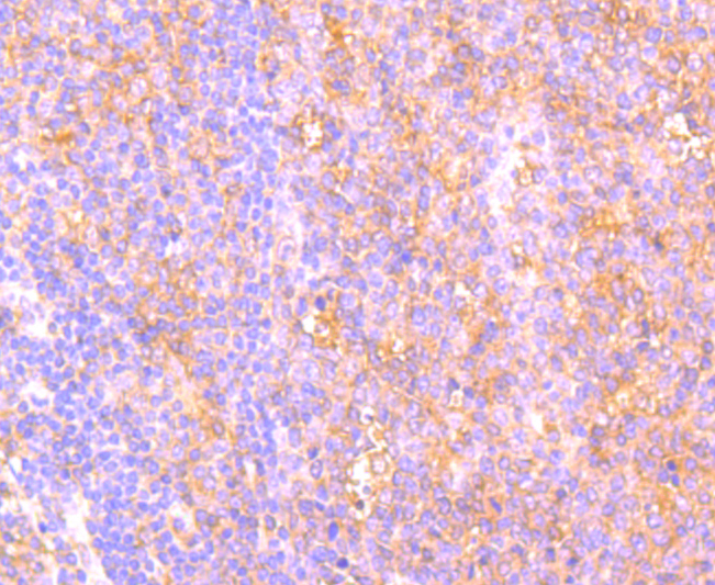 Immunohistochemical analysis of paraffin-embedded human spleen tissue using anti-C14orf93 antibody. Counter stained with hematoxylin.