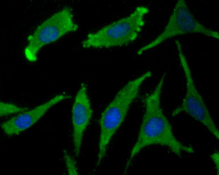 ICC staining WSCD2 in SH-SY5Y cells (green). The nuclear counter stain is DAPI (blue). Cells were fixed in paraformaldehyde, permeabilised with 0.25% Triton X100/PBS.