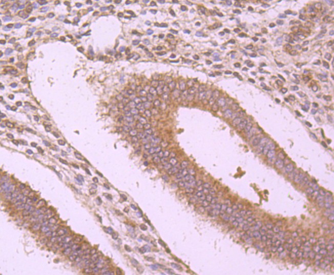 Immunohistochemical analysis of paraffin-embedded human uterus tissue using anti-WSCD2 antibody. Counter stained with hematoxylin.