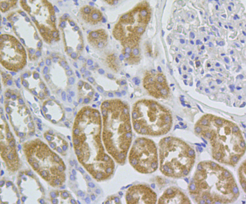 Immunohistochemical analysis of paraffin-embedded human kidney tissue using anti-C1orf175 antibody. Counter stained with hematoxylin.
