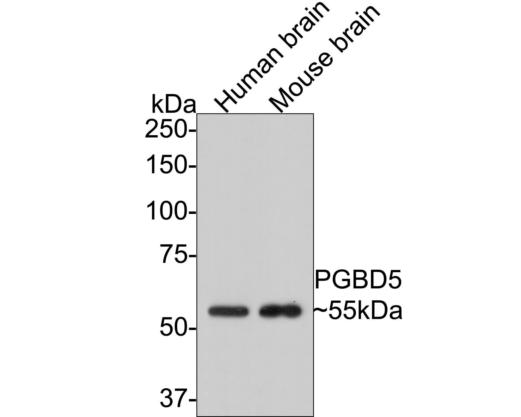 Western blot analysis of PGBD5 on different lysates with Mouse anti-PGBD5 antibody (M1012-1) at 1/500 dilution.<br />
<br />
Lane 1: Human brain tissue lysate<br />
Lane 2: Mouse brain tissue lysate<br />
<br />
Lysates/proteins at 20 µg/Lane.<br />
<br />
Predicted band size: 58 kDa<br />
Observed band size: 55 kDa<br />
<br />
Exposure time: 2 minutes;<br />
<br />
8% SDS-PAGE gel.<br />
<br />
Proteins were transferred to a PVDF membrane and blocked with 5% NFDM/TBST for 1 hour at room temperature. The primary antibody (M1012-1) at 1/500 dilution was used in 5% NFDM/TBST at room temperature for 2 hours. Goat Anti-Mouse IgG - HRP Secondary Antibody (HA1006) at 1:150,000 dilution was used for 1 hour at room temperature.
