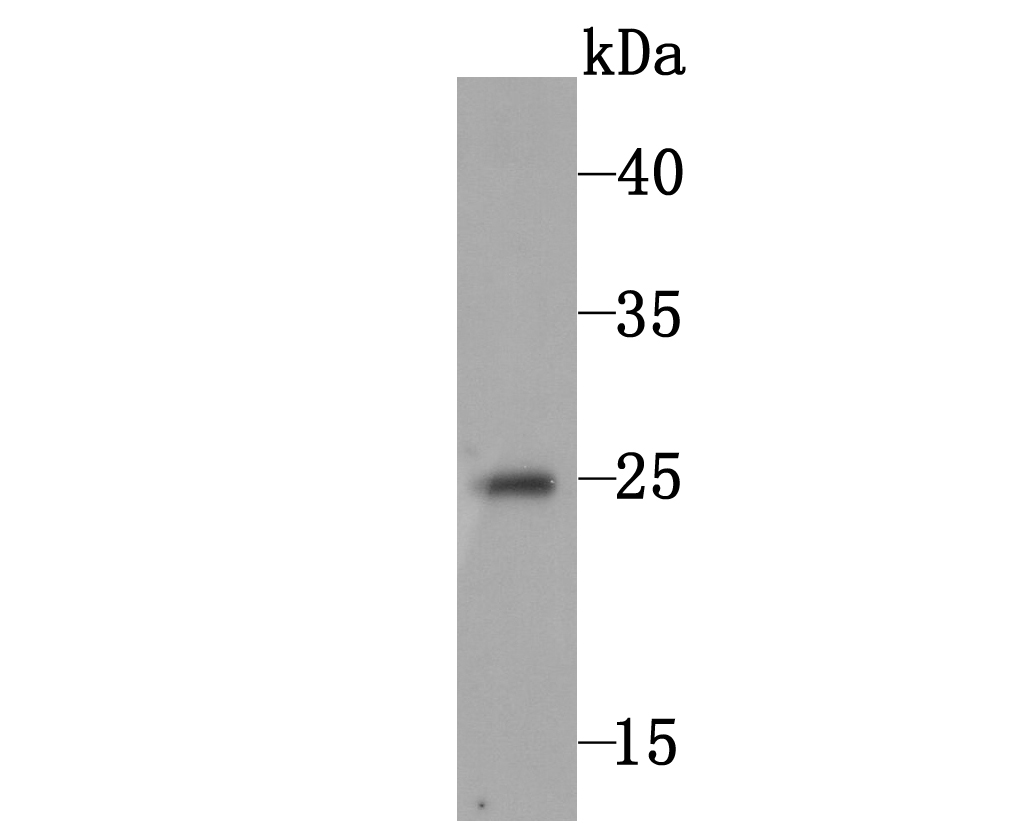 Western blot analysis of C10orf58 on human skin tissue lysate using anti-C10orf58 antibody at 1/1000 dilution.