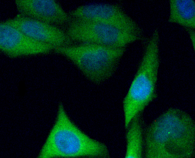 ICC staining C10orf58 (green) in PC-3M cells. The nuclear counter stain is DAPI (blue). Cells were fixed in paraformaldehyde, permeabilised with 0.25% Triton X100/PBS.