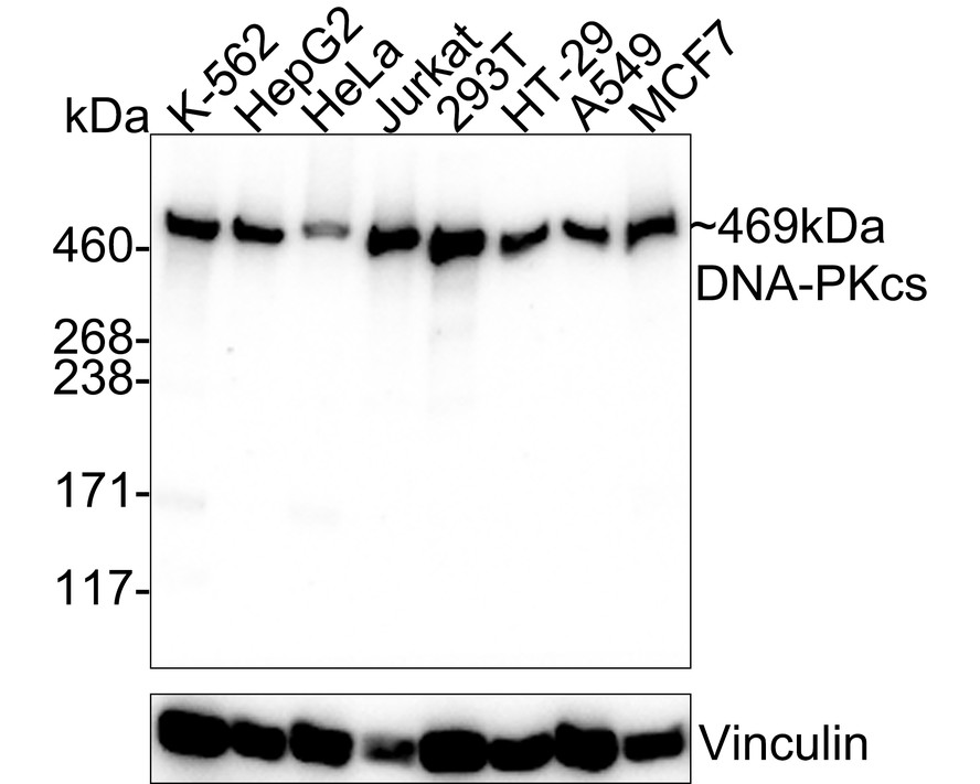 Western blot analysis of DNA-PKcs/PRKDC on different lysates with Mouse anti-DNA-PKcs/PRKDC antibody (M1204-6) at 1/2,000 dilution.<br />
<br />
Lane 1: K-562 cell lysate<br />
Lane 2: HepG2 cell lysate<br />
Lane 3: HeLa cell lysate<br />
Lane 4: Jurkat cell lysate<br />
Lane 5: 293T cell lysate<br />
Lane 6: HT-29 cell lysate<br />
Lane 7: A549 cell lysate<br />
Lane 8: MCF7 cell lysate<br />
<br />
Lysates/proteins at 20 µg/Lane.<br />
<br />
Predicted band size: 469 kDa<br />
Observed band size: 469 kDa<br />
<br />
Exposure time: 23 seconds;<br />
<br />
3-8% SDS-PAGE gel.<br />
<br />
Proteins were transferred to a PVDF membrane and blocked with 5% NFDM/TBST for 1 hour at room temperature. The primary antibody (M1204-6) at 1/2,000 dilution was used in 5% NFDM/TBST at 4℃ overnight. Goat Anti-Mouse IgG - HRP Secondary Antibody (HA1006) at 1/50,000 dilution was used for 1 hour at room temperature.