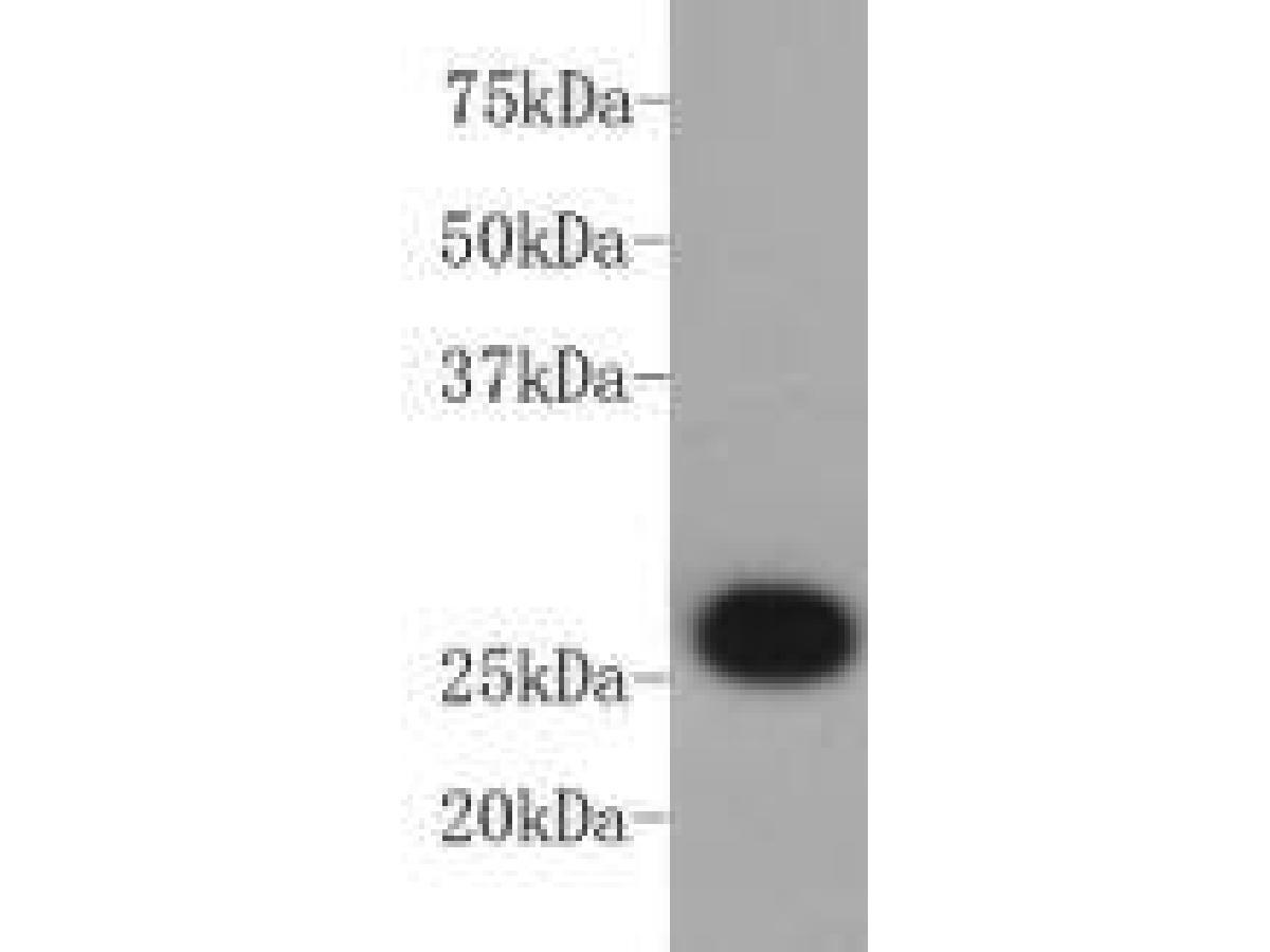 Western blot analysis of BCL-2 on Jurkat cell lysate using anti-BCL-2 antibody at 1/100 dilution.