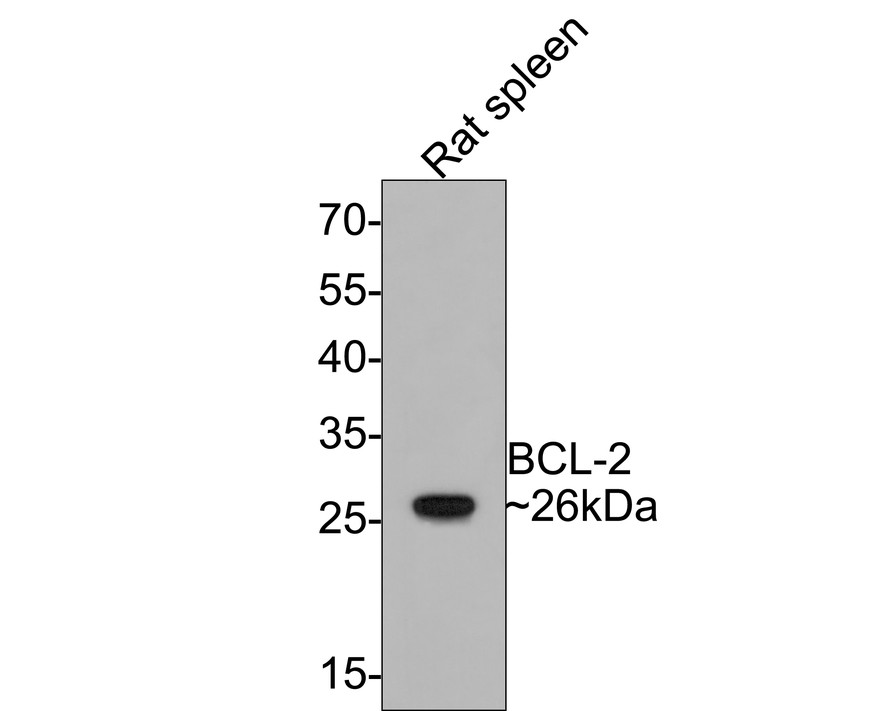 Western blot analysis of BCL-2 on rat spleen tissue lysates with Rabbit anti-BCL-2 antibody (M1206-4) at 1/500 dilution.<br />
<br />
Lysates/proteins at 10 µg/Lane.<br />
<br />
Predicted band size: 26 kDa<br />
Observed band size: 26 kDa<br />
<br />
Exposure time: 2 minutes;<br />
<br />
12% SDS-PAGE gel.<br />
<br />
Proteins were transferred to a PVDF membrane and blocked with 5% NFDM/TBST for 1 hour at room temperature. The primary antibody (M1206-4) at 1/500 dilution was used in 5% NFDM/TBST at room temperature for 2 hours. Goat Anti-Mouse IgG - HRP Secondary Antibody (HA1006) at 1:100,000 dilution was used for 1 hour at room temperature.