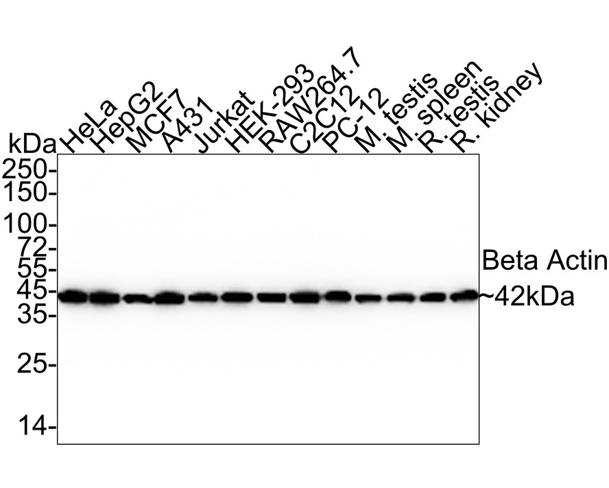 Beta actin Mouse Monoclonal Antibody [B4-B2] (M1210-2) – HUABIO