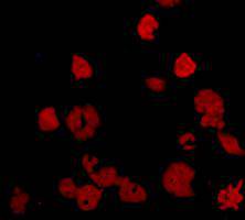 Immunofluorescent staining of Hela cells using anti-KIAA0100  Mouse mAb (Cat. # M1210-6).