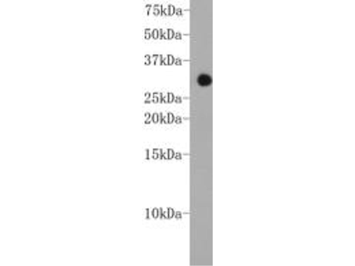 Western blot analysis on recombinant  protein using anti-CHD1 Mouse mAb (Cat. # M1211-5).