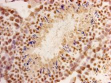 Immunohistochemical analysis of paraffin- embedded mouse testis tissue using anti-CHD1 Mouse mAb (Cat. # M1211-5).