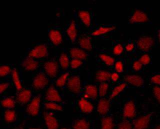 N-Cadherin Mouse Monoclonal Antibody [A10-4] - image 2