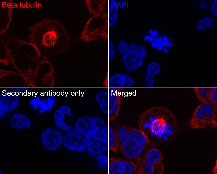 Immunohistochemical analysis of paraffin-embedded human tonsil tissue using anti-beta tubulin antibody. Counter stained with hematoxylin.