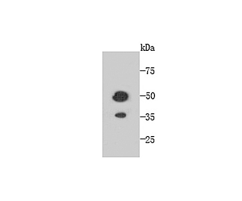 Western blot analysis of TMEM177 on recombinant protein using anti-TMEM177 antibody at 1/1,000 dilution.