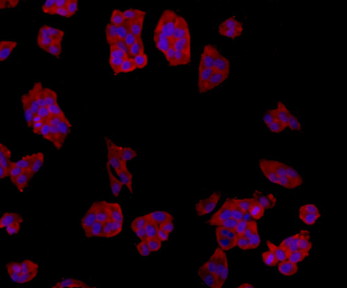 ICC staining TMEM177 in Hela cells (red). The nuclear counter stain is DAPI (blue). Cells were fixed in paraformaldehyde, permeabilised with 0.25% Triton X100/PBS.