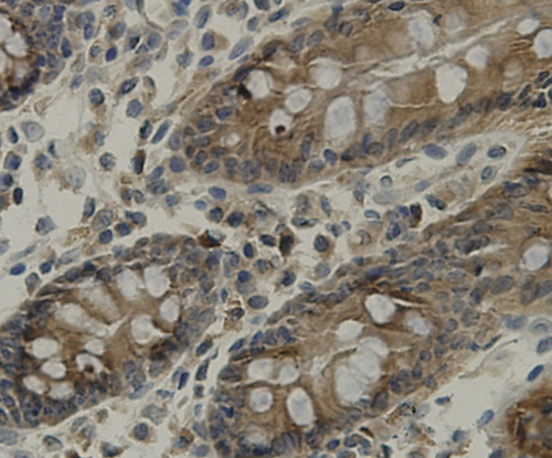 Immunohistochemical analysis of paraffin-embedded human colon tissue using anti-TMEM177 antibody. Counter stained with hematoxylin.