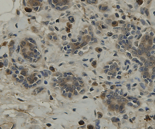 Immunohistochemical analysis of paraffin-embedded human breast tissue using anti-TMEM177 antibody. Counter stained with hematoxylin.