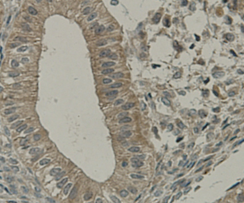 Immunohistochemical analysis of paraffin-embedded human uterus muscle tissue using anti-TMEM177 antibody. Counter stained with hematoxylin.
