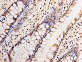 Immunohistochemical analysis of paraffin-embedded human intestine tissue using anti-GATA4 antibody. The section was pre-treated using heat mediated antigen retrieval with Tris-EDTA buffer (pH 9.0) for 20 minutes.The tissues were blocked in 1% BSA for 30 minutes at room temperature, washed with ddH2O and PBS, and then probed with the primary antibody (M1306-2, 1/50) for 30 minutes at room temperature. The detection was performed using an HRP conjugated compact polymer system. DAB was used as the chromogen. Tissues were counterstained with hematoxylin and mounted with DPX.