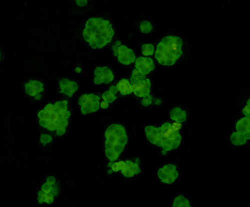 ICC staining Fam55C in NCCIT cells (green). Cells were fixed in paraformaldehyde, permeabilised with 0.25% Triton X100/PBS.