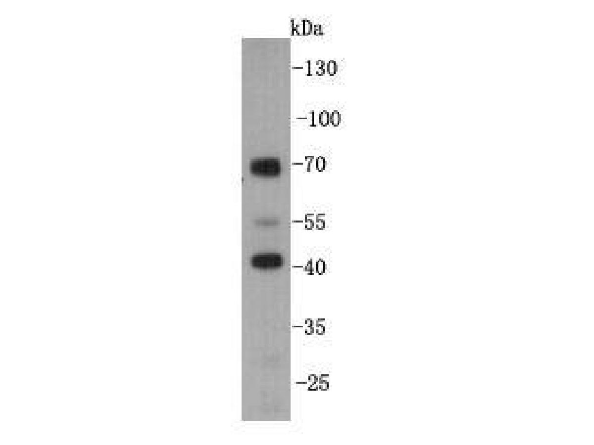 Western blot analysis on mouse testis tissue lysates using anti-KLHDC3 mouse mAb.