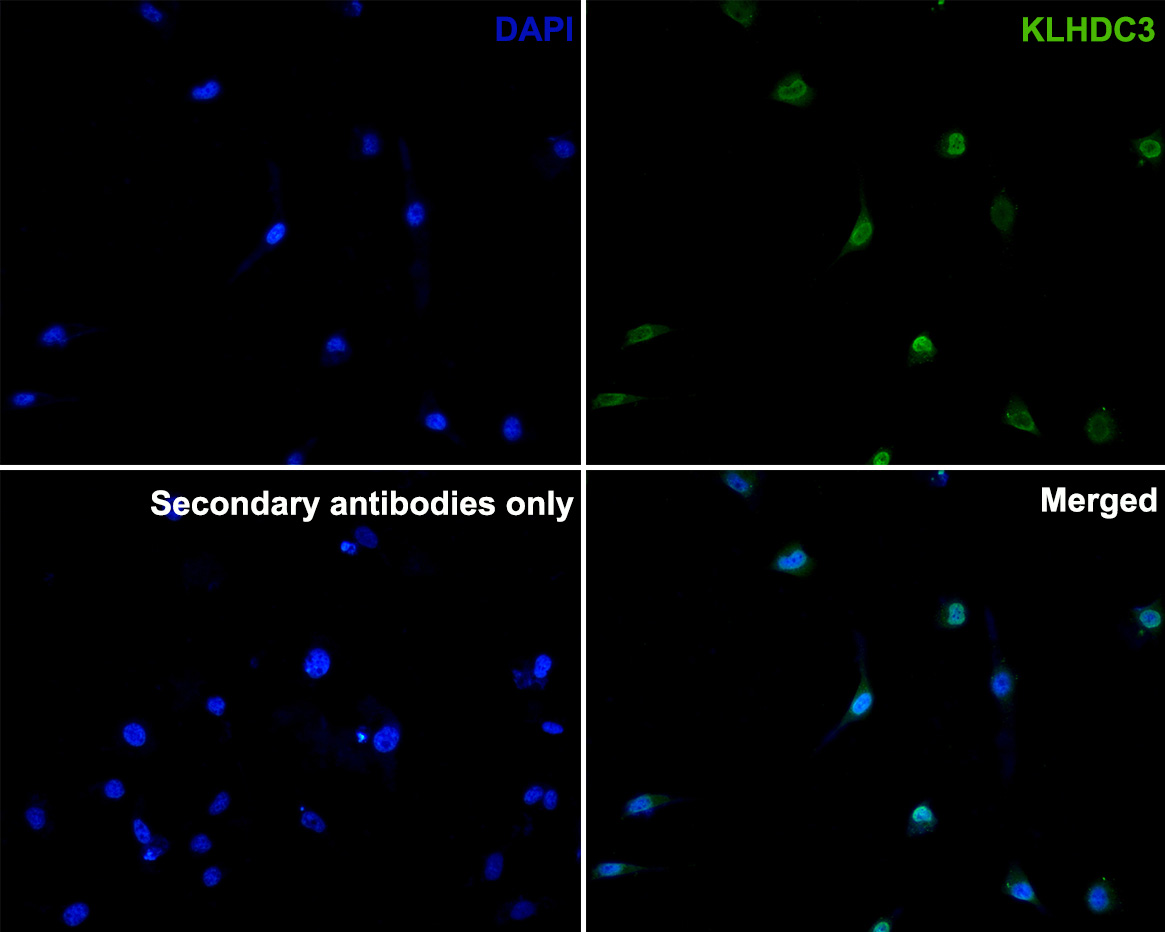 Immunocytochemistry analysis of Hela cells labeling KLHDC3 with Mouse anti-KLHDC3 antibody (M1310-1) at 1/50 dilution.<br />
<br />
Cells were fixed in 4% paraformaldehyde for 10 minutes at 37 ℃, permeabilized with 0.05% Triton X-100 in PBS for 20 minutes, and then blocked with 2% negative goat serum for 30 minutes at room temperature. Cells were then incubated with Mouse anti-KLHDC3 antibody (M1310-1) at 1/50 dilution in 2% negative goat serum overnight at 4 ℃. Goat Anti-Mouse IgG H&L (iFluor™ 488, HA1125) was used as the secondary antibody at 1/1,000 dilution. PBS instead of the primary antibody was used as the secondary antibody only control. Nuclear DNA was labelled in blue with DAPI.